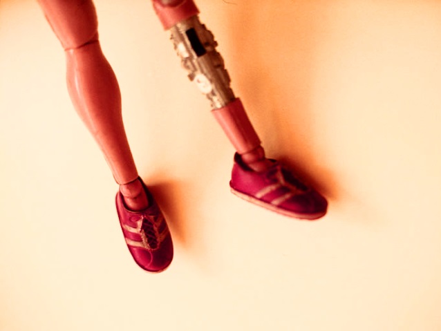Nogi lalki, jedna z bioprotezą/sxc.hu