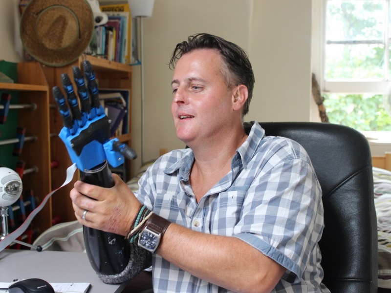 Liam Corbett przymierzający wydrukowaną protezę dłoni/ fot. openhandproject.org