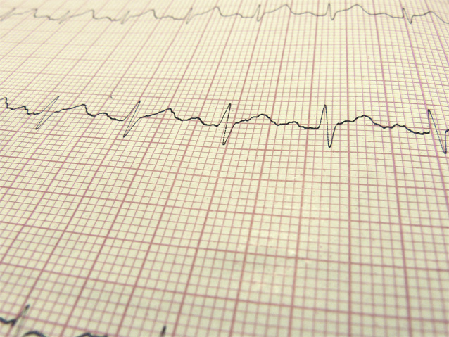 Wykres EKG na papierze