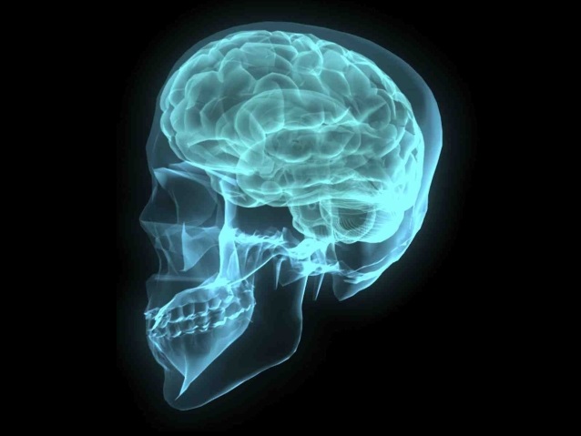 Prześwietlenie czaszki z widocznym mózgiem